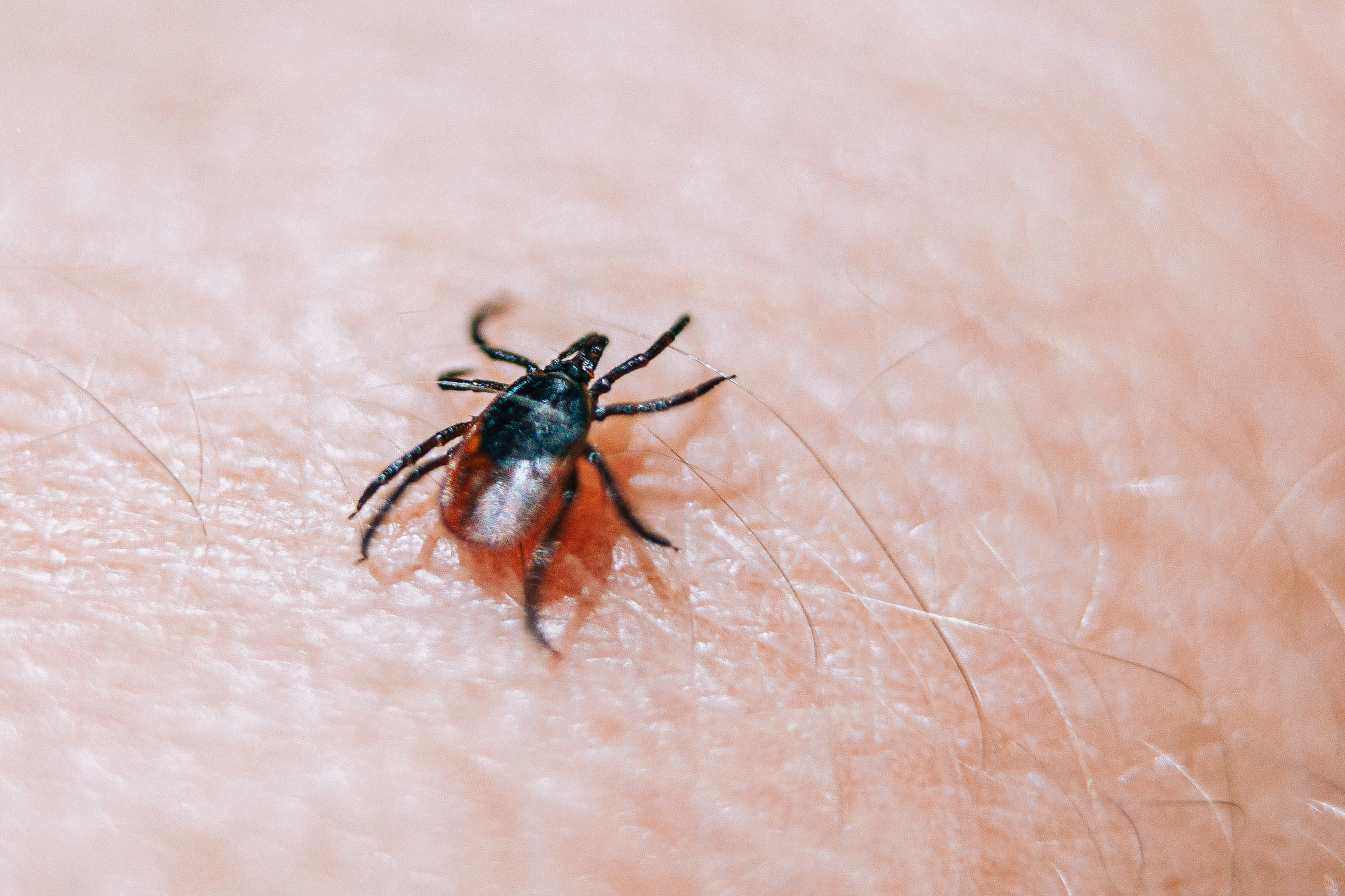 Dangerous deer tick crawling on human skin